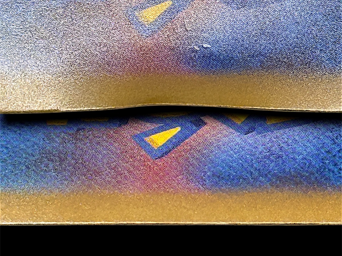 縁のめくれ（Edge Lift）の症例写真 2